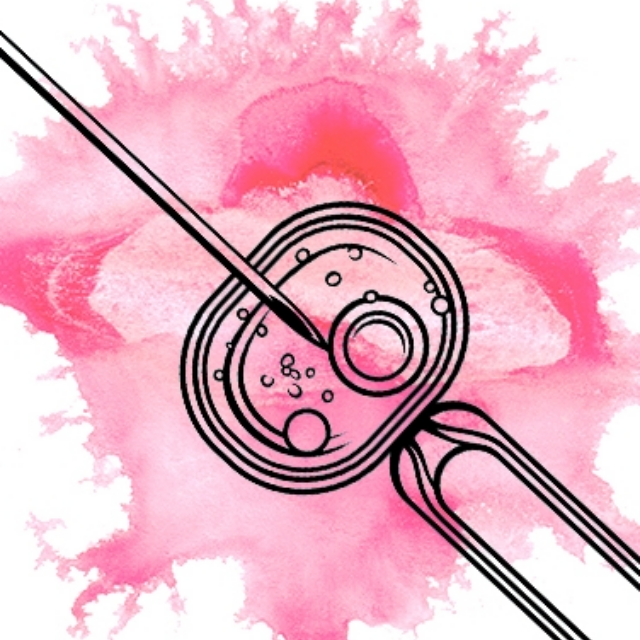 ICSI – INTRACYTOPLASMIC SPERM INJECTION