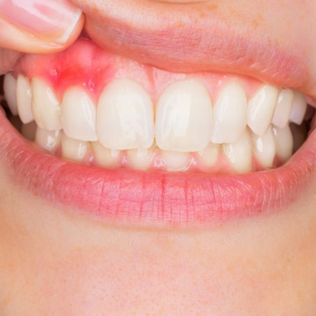 What Can Adults Do to Maintain Good Oral Health?