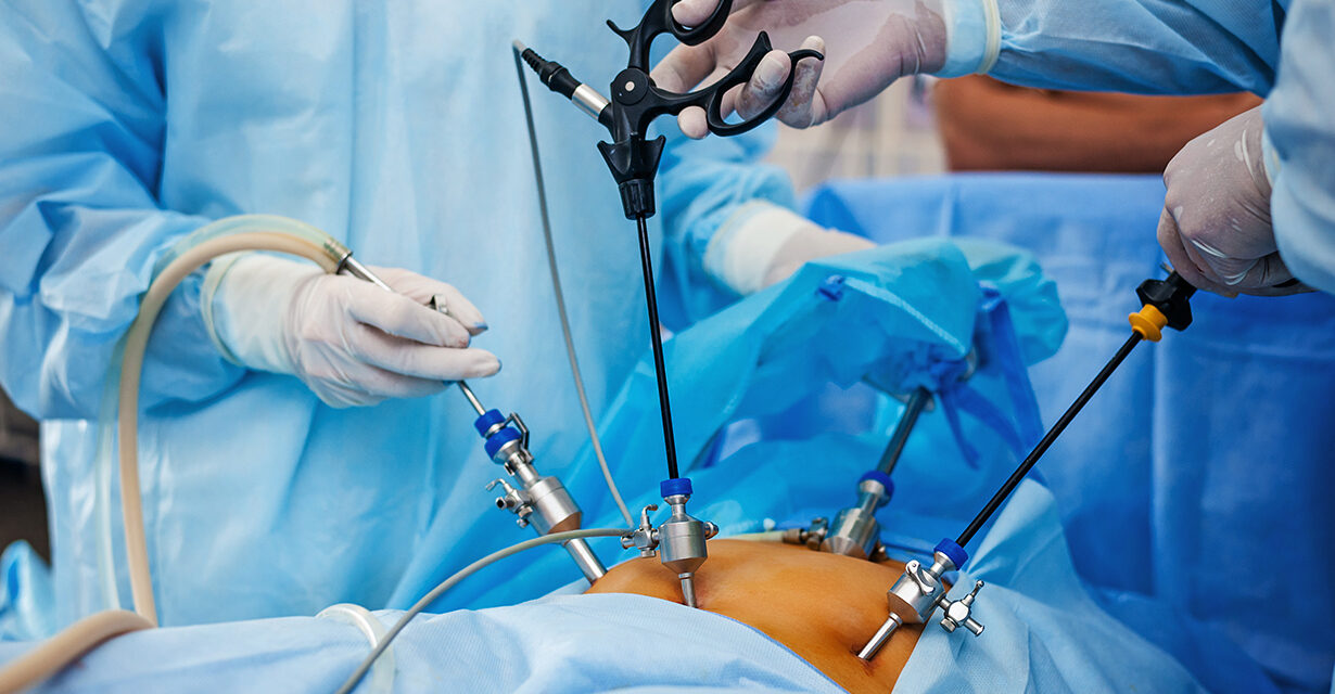 लेप्रोस्कोपी सर्जरी क्या है और क्यों किया जाता है?